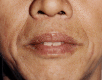 面相分析:8、下停─人中和法令