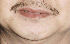 面相分析:9、下停─口与下巴