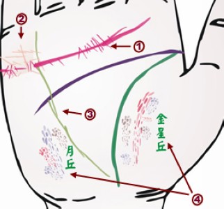 手相看病图解