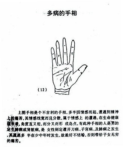 多病的手相图解