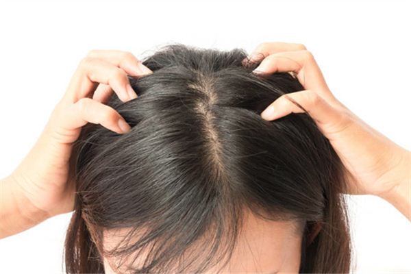 梦见别人头上长虱子_周公解梦梦到别人头上长虱子是什么意思_做梦梦见别人头上长虱子好不好_周公解梦官网