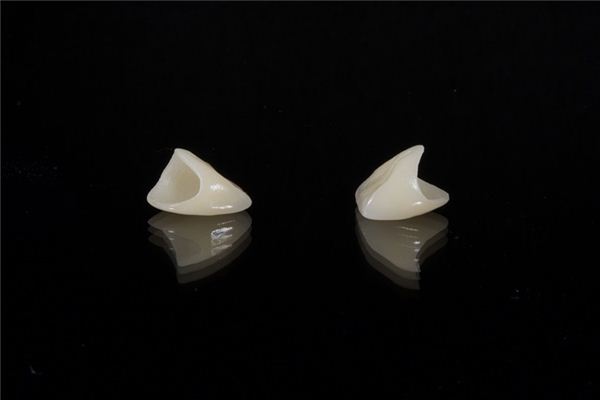 梦见掉下牙是什么意思