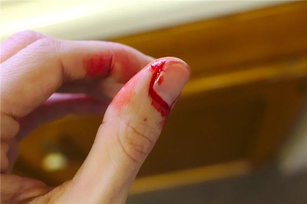 梦见手指破了流血