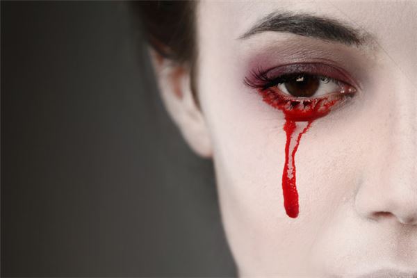 梦见眼睛流血