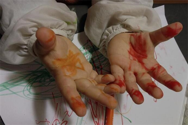 梦到手掌出血有什么说法