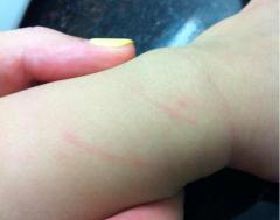 梦境之谜，解析梦见有人手部被猫抓伤流血的深层含义