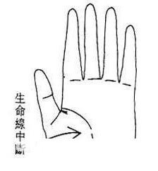 生命线断开图解