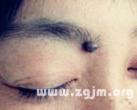 禾秆盖珍珠痣