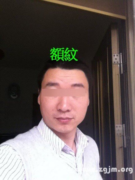 满额疮痍有额纹额多杂毛眉乱的照片分析